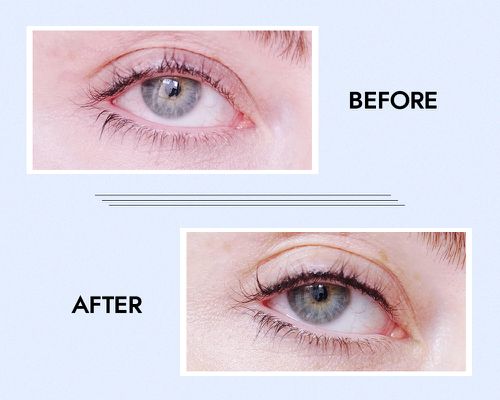 permanent eyeliner before and after